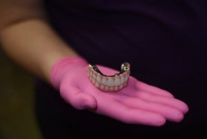 Dentures Model