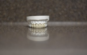 Dental Crowns and Bridges Model