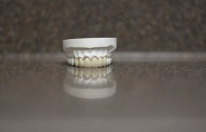 Dental Crowns and Bridges Model