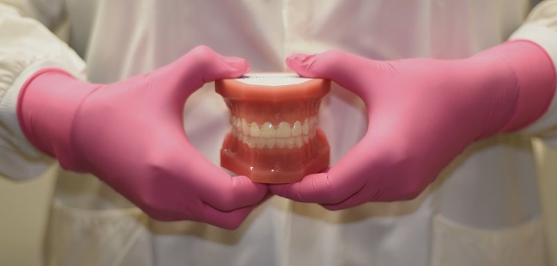 Invisalign Model